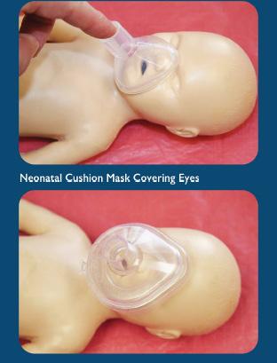 Preemie anatomisk mask Mjuk silikonmask för barn med