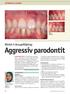 Aggressiv parodontit. Klinisk 3-årsuppföljning: VETENSKAP & KLINIK