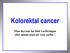 Kolorektal cancer. Man ska inte ha blod i avföringen eller anemi utan att veta varför!