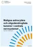 Maligna astrocytära och oligodendrogliala tumörer i centrala nervsystemet Nationellt vårdprogram