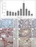 Evaluation of Correlation between mrna and Protein. Expression of Tripeptidyl-Peptidase II: Possible Future Use as a Biomarker for Cancer?