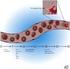 The impact of platelet storage time on transfusion results