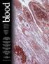 Detection and quantification of fetal hemoglobin in blood using flow cytometry