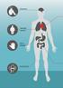 Depression. Metabolt syndrom. Typ 2- diabetes. Psoriasisartrit