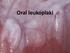 Oral leukoplaki (ange enhet via Infoga sidfot)