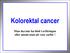 Kolorektal cancer. Man ska inte ha blod i avföringen eller anemi utan att veta varför!