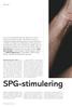 SPG-stimulering. Under senare år har nya metoder för neurostimulation utvecklats där små stimulatorer