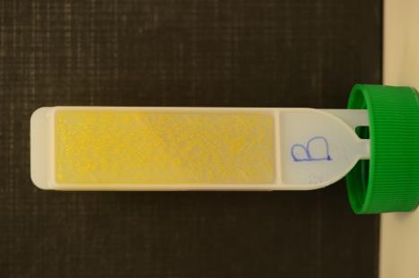 I 19 prov kunde växt påvisas vid båda de initiala odlingssätten.
