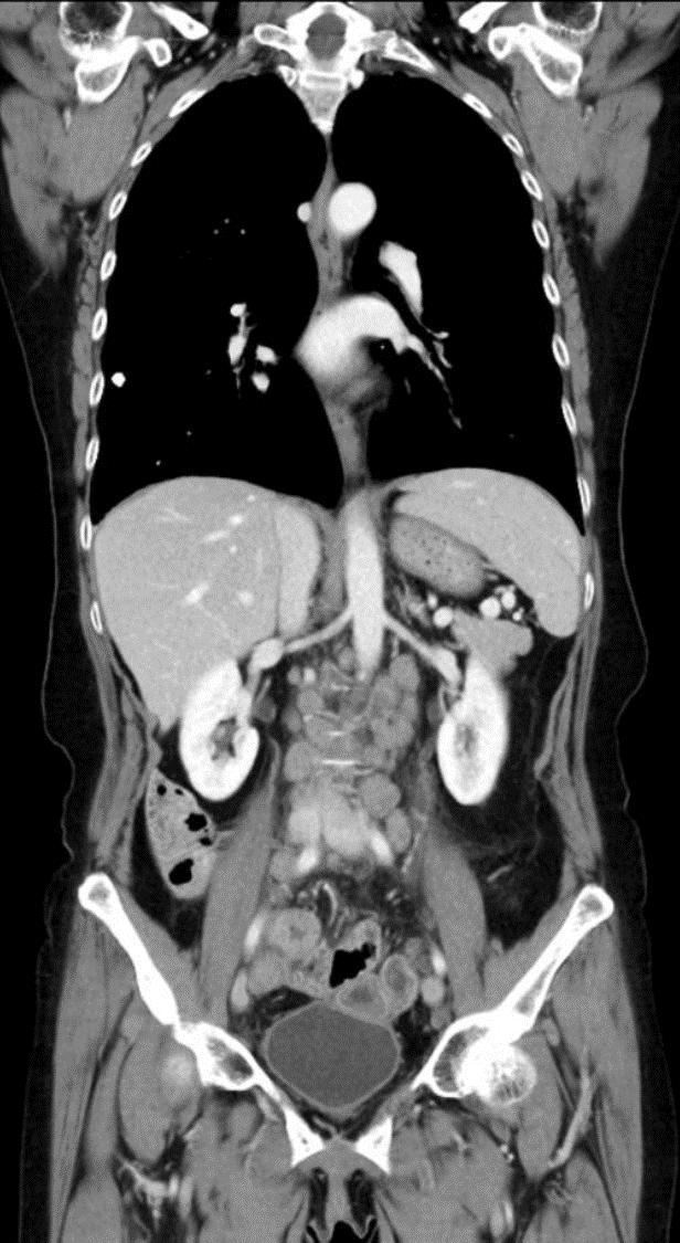 Värdet av radiologi vid kontroller?