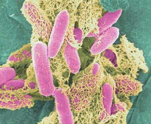 4 Multiresistenta gramnegativa tarmbakterier (ESBL); ett hot mot vården och folkhälsan TEXT: Thomas Ahlqvist Redan på 1980-talet upptäcktes enzymer hos E coli och Klebsiella pneumoniae som förmådde