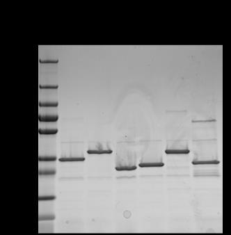 Figure 2: Gel from SDS PAGE analysis of