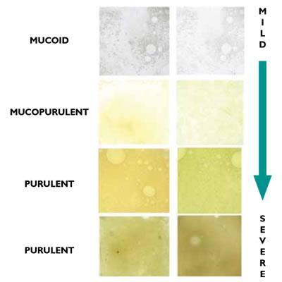 Vid pneumonier Odling PCR Representativt