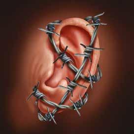 framtida negativ hörselutveckling. Känner du till dina rättigheter, möjligheter och skyldigheter som rör hörseln?