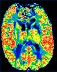Perfusion/Diffusion: Patient
