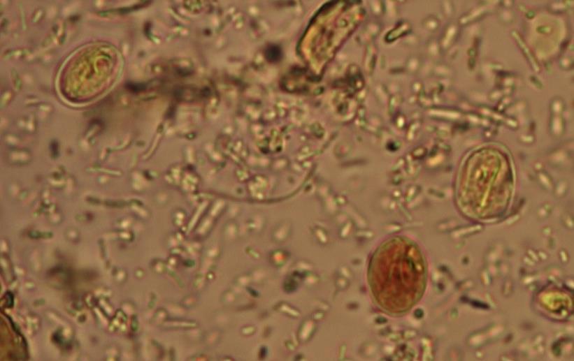 Giardia intestinalis Vanligaste orsaken