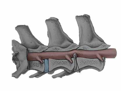 Det rör sig i själva verket om två olika sjukdomar och mycket tyder på att de har en ärftlig bakgrund. 1. Spondylos 2. DISH, vilket är en förkortning för Diffuse Idiopathic Skeletal Hyperostosis.