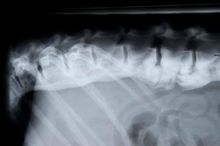 Vad är DISH och vilken är orsaken? DISH, Diffuse Idiopathic Skeletal Hyperostosis, betyder ungefär diffus bennybildning i skelettet av okänd orsak.