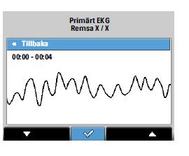 Primärt EKG visas i 4-sekunderssegment på skärmar som visas efter varandra. Om du vill flytta till nasta EKG-skärm trycker du pa alternativknappen.
