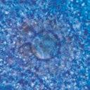 ivf-behandling in vitro-fertilisering är den mest effektiva metoden för att behandla ofrivillig barnlöshet Ofrivillig barnlöshet Världshälsoorganisationen (WHO) uppskattar att cirka 10 procent av