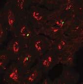 The graph shows adoptively transferred activated GFP + B cells from PP were, indeed, capable of repopulating recipient PPs in the presence of antigen while in CD40L treated recipient group, GFP+ B