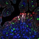 perform an antigen transporting function in the PP. For trafficking of B cells from SED to GC or GC to SED the expression of migratory markers like CCR6 and CXCR5 will be critical.
