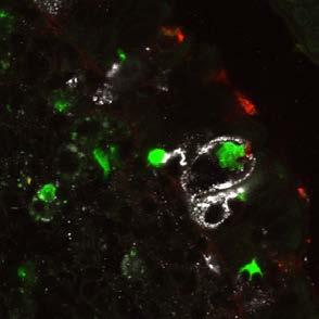 had bound PE labeled antigen.