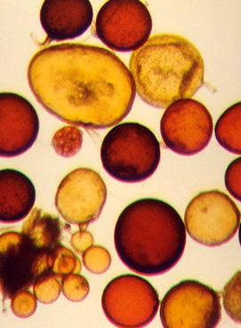 allmänhet de växtätande, parasitära nematoderna som oftast får uppmärksamhet eftersom några av dem är allvarliga skadegörare på betor, potatis, morot och spannmål.