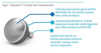 Episealer Trochlea Solo (CE-godkänd, Klass IIb, år 2014) Episealer Femoral Twin (CE-godkänd, Klass IIb, år 2015) De olika implantatmodellerna är alla ytersättningsimplantat för olika delar av