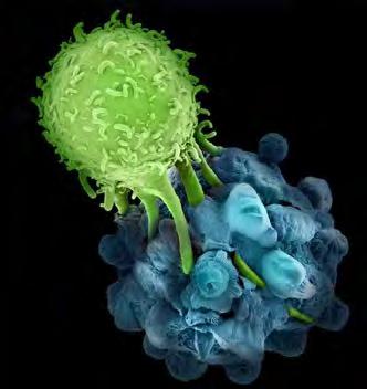 Immunterapi Cytokiner IFN/IL2 Antikroppar Vacciner Cellfraktioner
