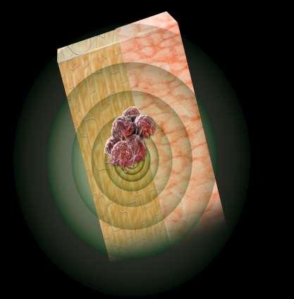 Ra223 Kort räckvidd ger låg benmärgstoxicitet α β Marrow Range of β-particle