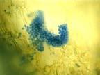 hair infection Aniline blue stained