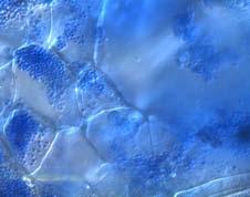 in host tissue Resting spores Primary