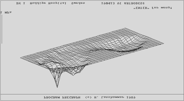 F skelett F akilles Fotled h akilles Tryckfördelning över fotsulan, stelopererad stortå F led = F skelett - F akilles Förenklad belastningsanalys i fotleden 13 14 Approximativa uttryck för