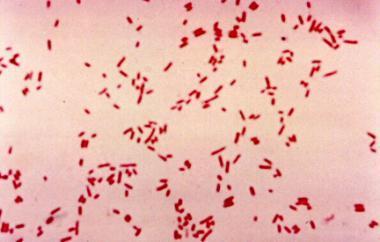 Enterobacterales (>8000) Escherichia coli Gramnegativa