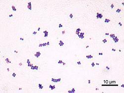 Staphylococcus aureus Grampositiva kocker Orsakar