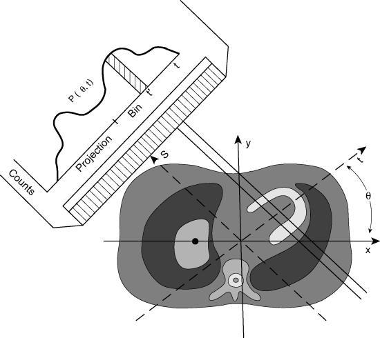 2.2 Single Photon Emission Computed Tomography (SPECT) 2.2.1 Reconstruction A two-dimensional planar image which represents the activity distribution in a patient can be obtained with the scintillation camera.