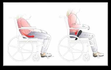 4 mm insexnyckel Höftremsfästet på sitsplattan kan flyttas mellan 7 olika positioner för att ge optimal höftposition.
