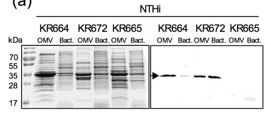 Figure 7. OMV from NTHi contain β-lactamase. SDS-gel and western blot showing OMV from β-lactamase positive NTHi strains KR664 and KR672 contain β-lactamase, as opposed to susceptible strain KR665.