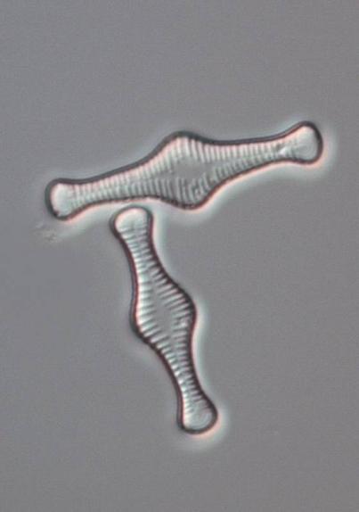 förekom rikligt i Linneån: Brachysira neoexilis, Caloneis tenuis, Encyonema neogracile, Gomphonema exilissimum, Microcostatus