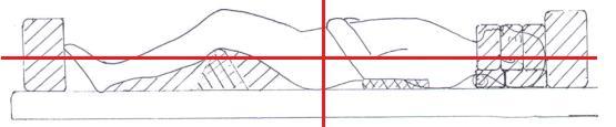 front of the patient, placed in a fix holder at the long axis of the couch, to generate electrons and improve the superficial dose.