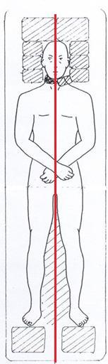 the laser in Figure 3.b. The gantry is rotated towards the patient and the collimator head is rotated to produce the largest possible field diagonally with the jaws at 38 38 cm 2.