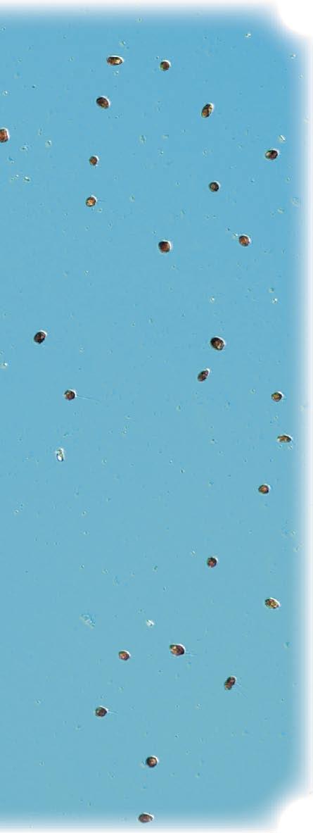 Eastern Gotland Basin BY1 13 th of November The prymnesiophyte Chrysochromulina polylepis* was the most numerous species. Small cryptomonads were abundant, and the prasinophyte Pyramimonas spp.