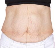 ageloc Galvanic Body Trio Med ett verkligt avancerat system för kroppen är det nu dags att ta vetenskapen kring hudens åldrande ett steg längre.