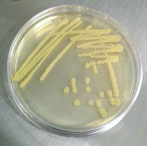 mikroorganismer och förvaring av mikroorganismer. Vi kommer att testa enkla försök med mikroorganismer som lämpar sig för elever att genomföra, se nedan.