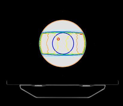 and the other used treatment technique (TH or 3DCRT) are equal. H1: TD is superior to the other used treatment technique. 4.2.6. Delta 4 measurements 4.2.6.1. Preparation before measurements Before the Delta 4 phantom+ measurements, DQA plans were generated in the DQA software version 5.
