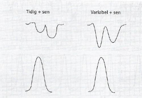 tidig / variabel + Uniform