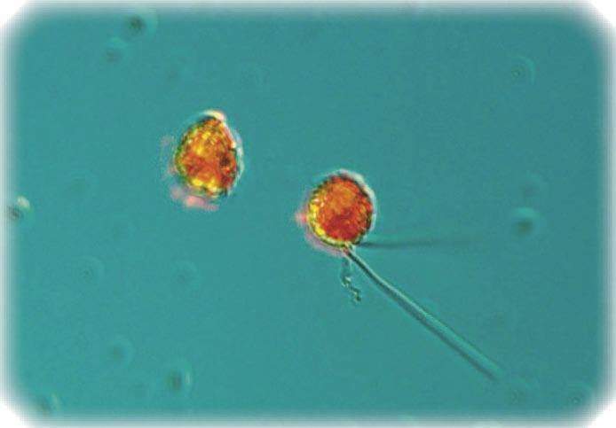 The Baltic Sea Arkona Basin BY2 18 th of March The diatom Skeletonema costatum and the prymnesiophyte Chrysochromulina polylepis* dominated the phytoplankton sample.