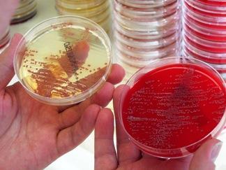Riktvärden mikrobiologisk kontroll enligt ESGE-ESGENA : Sista sköljvatten diskdesinfektor/vattenflaska Frekvens: Minst var 3:e månad Gränsvärden: - Testorganismer: 0 CFU/ml - Totalantal: 10 CFU /100