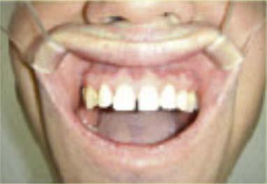 bättre renare dentalfoto