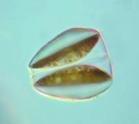 Släggö 13 th of November The plankton flora was somewhat richer in number of species as compared to Å17, but the cell numbers were still low.